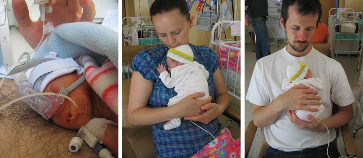 Rácz Bius története - Koraszülött történetek