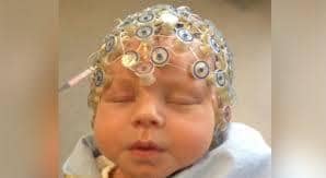 Mi az az EEG vizsgálat